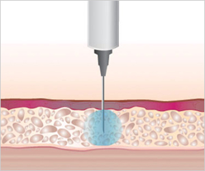 comfort-in needle injection